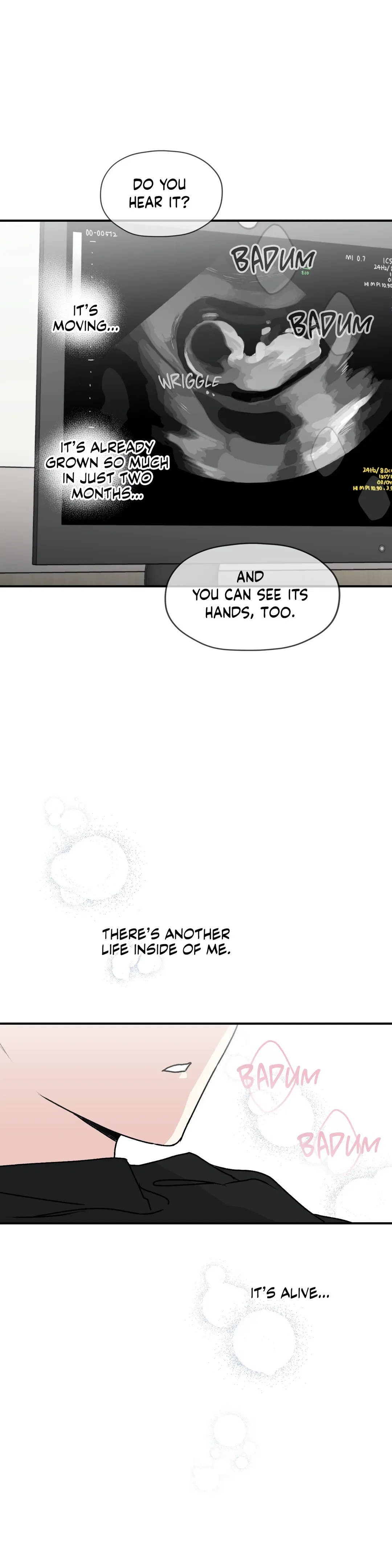 Surge Towards You Chapter 26 - Page 30